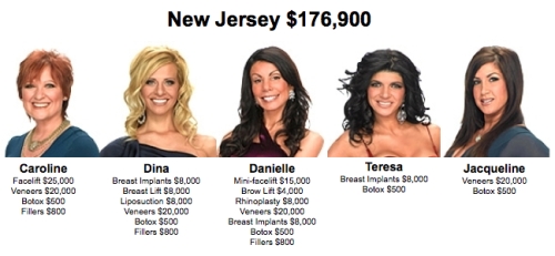New york housewives : new jersey housewives : celebrity cosmetic surgery : new york housewives vs new jersey housewives : breast implants : liposuction : facelift